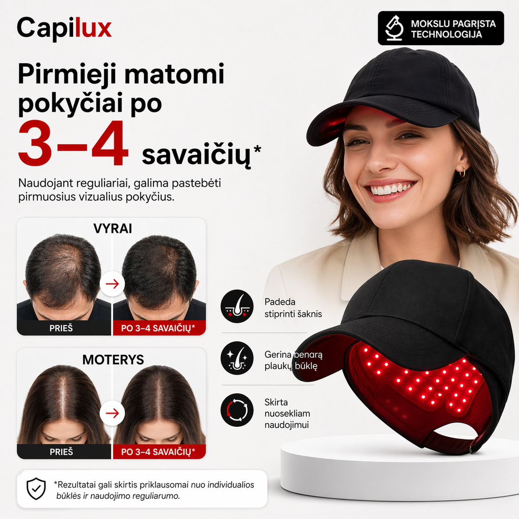Capilux – pažangi LLLT šviesos terapijos kepurė plaukų ir galvos odos priežiūrai